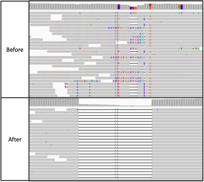从零开始完整学习全基因组测序（WGS）数据分析：第4节 构建WGS主流程